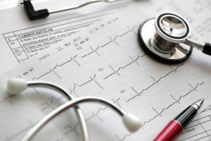 stethoscope and heart chart