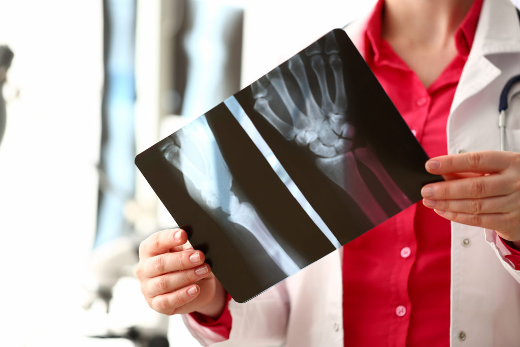 doctors looking at an x-ray