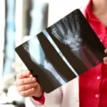 Do I Need to See a Medical Professional Within the First 14 Days After My Accident?