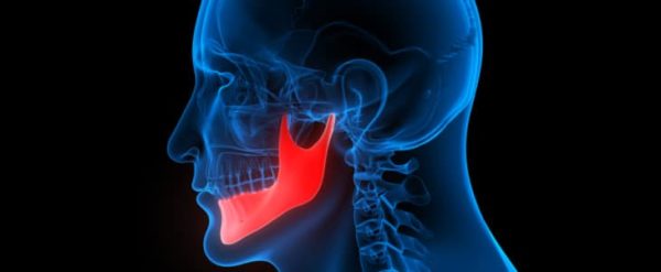 jaw pain xray with jaw highlighted in red