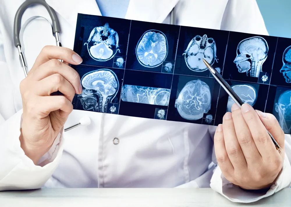 Atlanta Brain Injury Lawyer