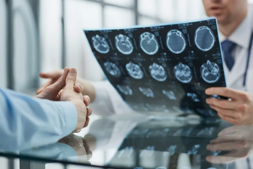 Los Angeles Brain Injury Lawyer